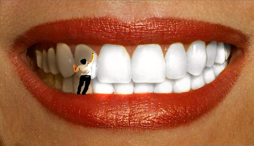 Задавайте ваші питання по відбілюванню зубів в    Питаннях та відгуках   